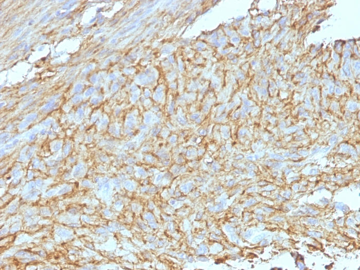 Immunohistochemistry (Formalin/PFA-fixed paraffin-embedded sections) - Anti-TMEM16A antibody [DG1/447 + DOG-1.1] (AB200486)