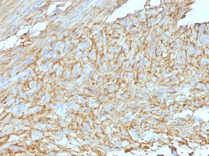 Immunohistochemistry (Formalin/PFA-fixed paraffin-embedded sections) - Anti-TMEM16A antibody [DG1/447 + DOG-1.1] (AB200486)