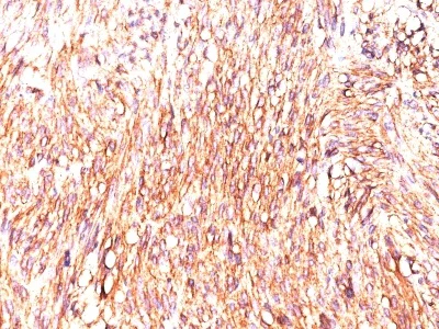 Immunohistochemistry (Formalin/PFA-fixed paraffin-embedded sections) - Anti-TMEM16A antibody [DOG-1.1] (AB233957)