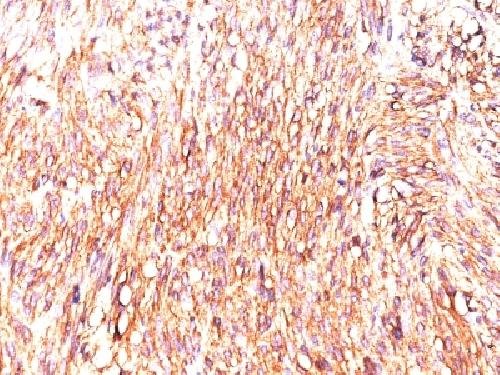 Immunohistochemistry (Formalin/PFA-fixed paraffin-embedded sections) - Anti-TMEM16A antibody [DOG-1.1] - BSA and Azide free (AB212744), expandable thumbnail