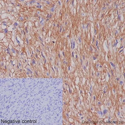 Immunohistochemistry (Formalin/PFA-fixed paraffin-embedded sections) - Anti-TMEM16A antibody [EPR10643(2)] - BSA and Azide free (AB251044)