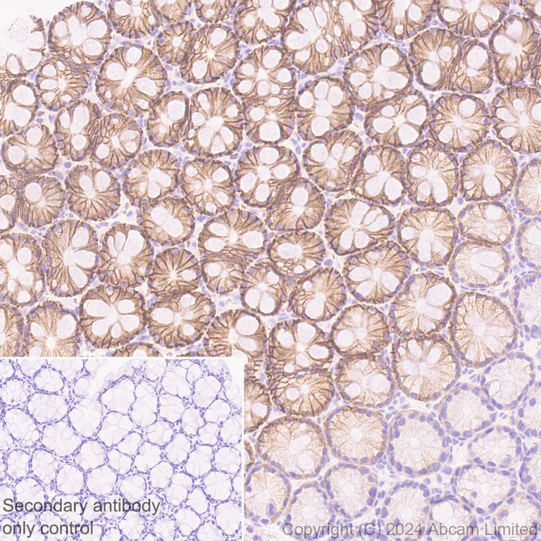 Immunohistochemistry (Formalin/PFA-fixed paraffin-embedded sections) - Anti-TMEM16A antibody [EPR29617-2] (AB323181)