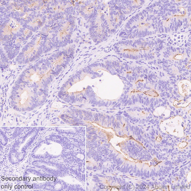 Immunohistochemistry (Formalin/PFA-fixed paraffin-embedded sections) - Anti-TMEM16A antibody [EPR29617-2] (AB323181)
