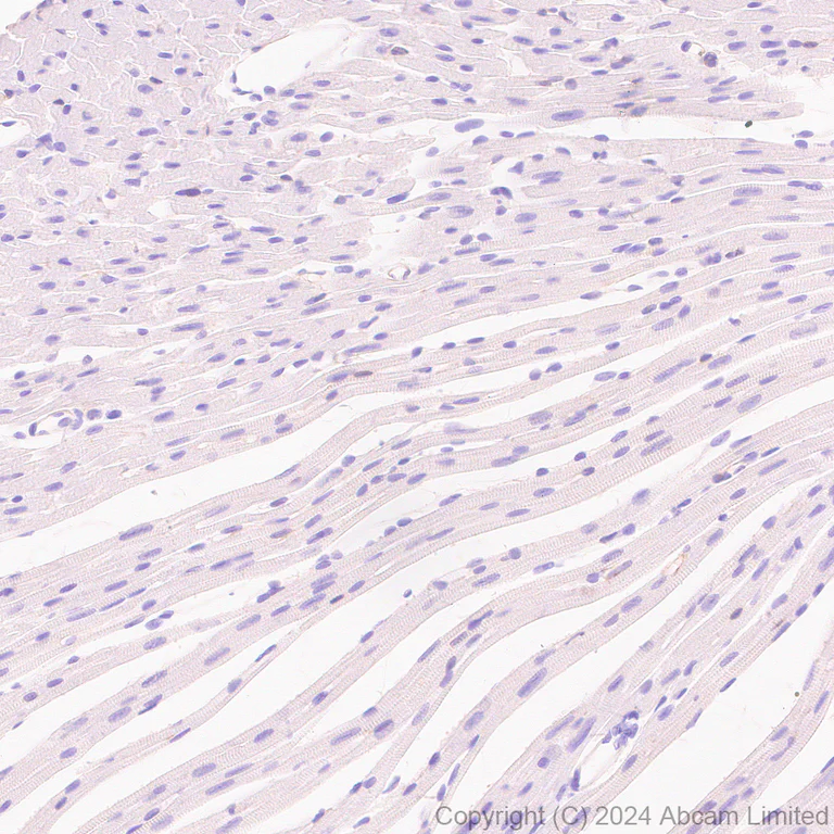 Immunohistochemistry (Formalin/PFA-fixed paraffin-embedded sections) - Anti-TMEM16A antibody [EPR29617-2] (AB323181)