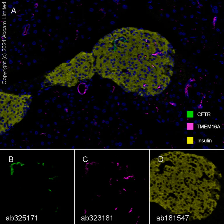 Multiplex immunohistochemistry - Anti-TMEM16A antibody [EPR29617-2] (AB323181)