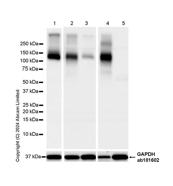 Western blot - Anti-TMEM16A antibody [EPR29617-2] (AB323181)