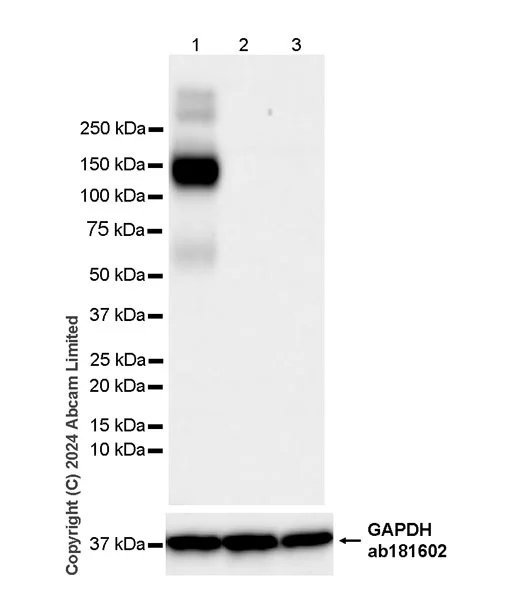 Western blot - Anti-TMEM16A antibody [EPR29617-2] (AB323181)