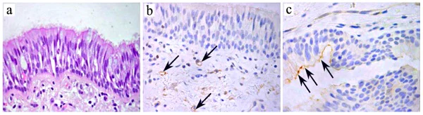 Immunohistochemistry (Formalin/PFA-fixed paraffin-embedded sections) - Anti-TMEM16A antibody [SP31] (AB64085)