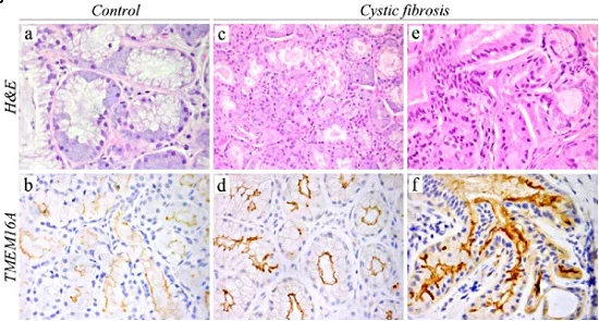 Immunohistochemistry (Formalin/PFA-fixed paraffin-embedded sections) - Anti-TMEM16A antibody [SP31] (AB64085)