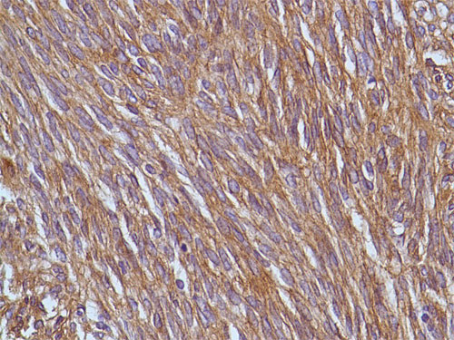 Immunohistochemistry (Formalin/PFA-fixed paraffin-embedded sections) - Anti-TMEM16A antibody [SP31] (AB64085)