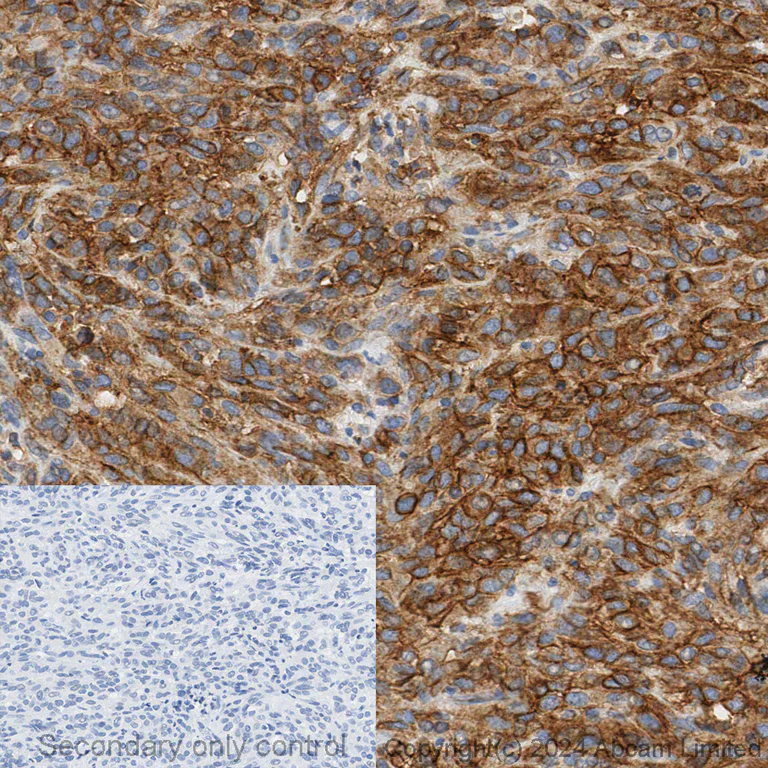 Immunohistochemistry - Anti-TMEM16A antibody [SP31] (AB64085)