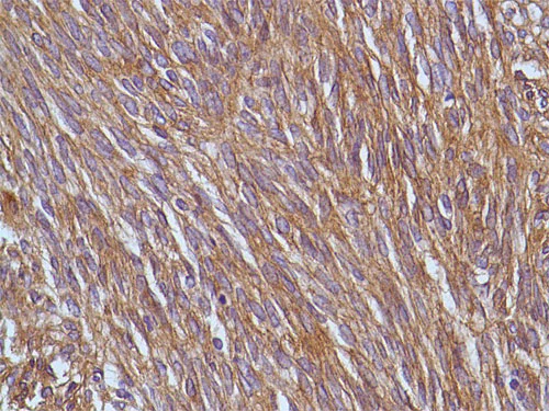 Immunohistochemistry (Formalin/PFA-fixed paraffin-embedded sections) - Anti-TMEM16A antibody [SP31] - BSA and Azide free (AB198412)