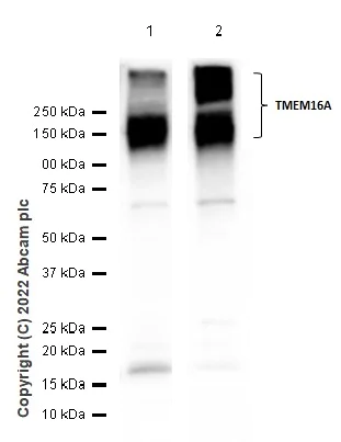 Western blot - Anti-TMEM16A antibody [SP31] - BSA and Azide free (AB198412)