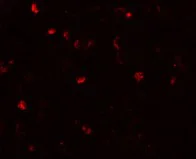 Immunocytochemistry/ Immunofluorescence - Anti-TMEM16B antibody (AB91573)