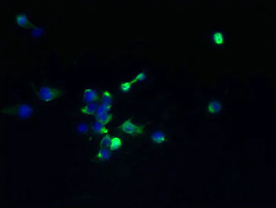 Immunocytochemistry/ Immunofluorescence - Anti-TMEM174 antibody (AB237680)
