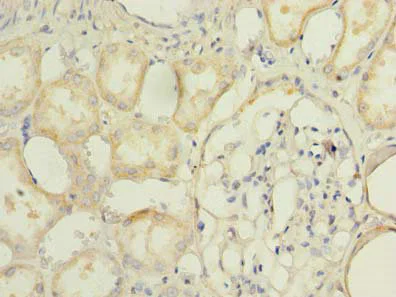Immunohistochemistry (Formalin/PFA-fixed paraffin-embedded sections) - Anti-TMEM174 antibody (AB237680)