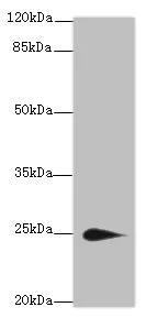 Western blot - Anti-TMEM174 antibody (AB237680)