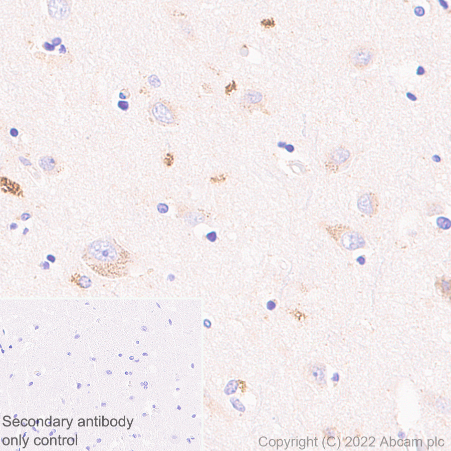 Immunohistochemistry (Formalin/PFA-fixed paraffin-embedded sections) - Anti-TMEM175 antibody [EPR24415-47] (AB300457)