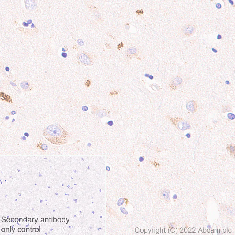 Immunohistochemistry (Formalin/PFA-fixed paraffin-embedded sections) - Anti-TMEM175 antibody [EPR24415-47] (BSA and Azide free) (AB300458)