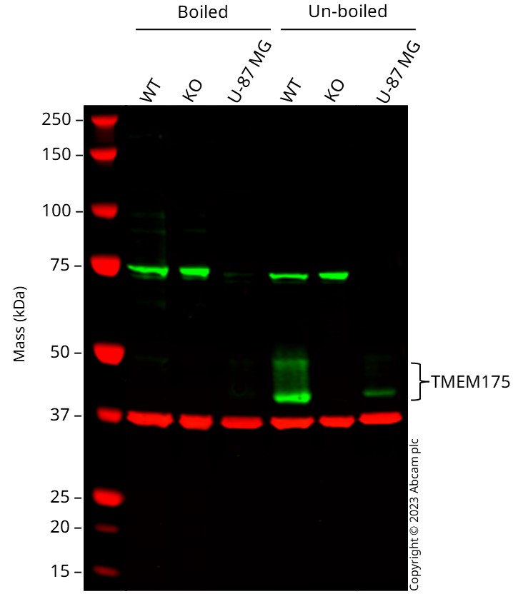 Western blot - Anti-TMEM175 antibody [EPR24415-47] (BSA and Azide free) (AB300458), expandable thumbnail