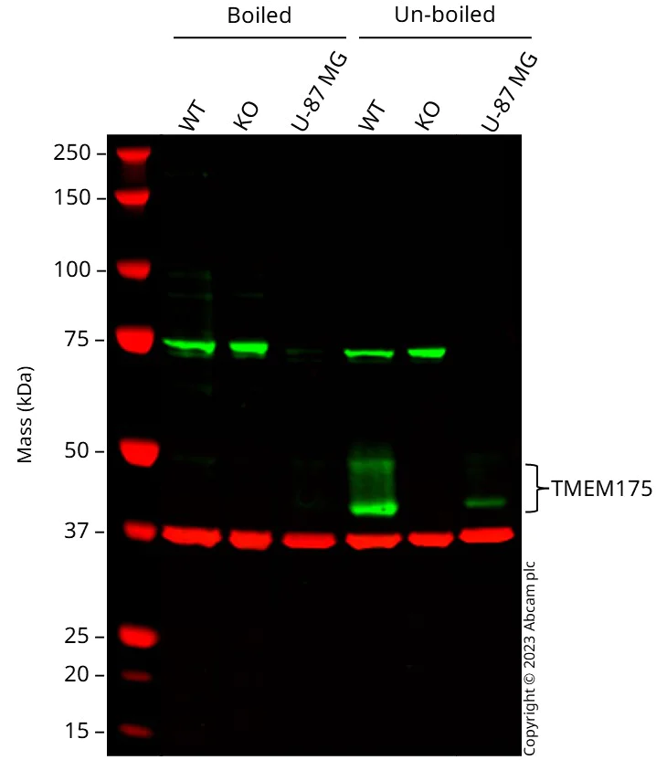 Western blot - Anti-TMEM175 antibody [EPR24415-47] (BSA and Azide free) (AB300458)