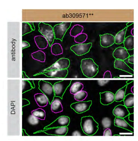 Immunocytochemistry/ Immunofluorescence - Anti-TMEM175 antibody [EPR26739-94] - BSA and Azide free (Capture) (AB309571)