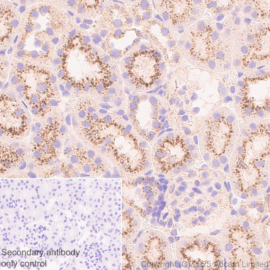Immunohistochemistry (Formalin/PFA-fixed paraffin-embedded sections) - Anti-TMEM175 antibody [EPR29579-563] (ab323710), expandable thumbnail