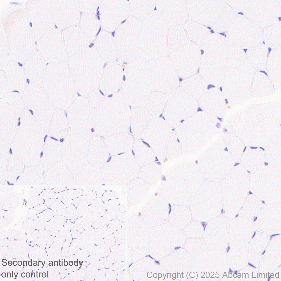Immunohistochemistry (Formalin/PFA-fixed paraffin-embedded sections) - Anti-TMEM175 antibody [EPR29579-563] (ab323710), expandable thumbnail