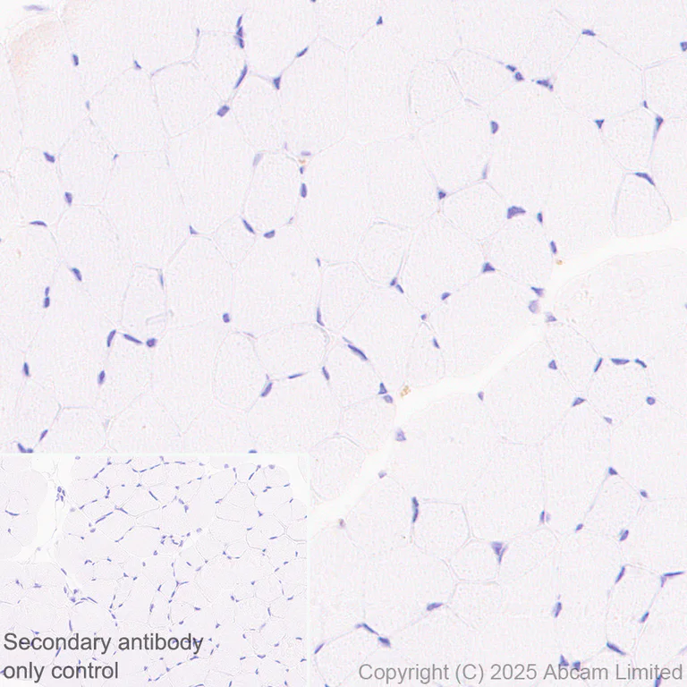 Immunohistochemistry (Formalin/PFA-fixed paraffin-embedded sections) - Anti-TMEM175 antibody [EPR29579-563] (AB323710)
