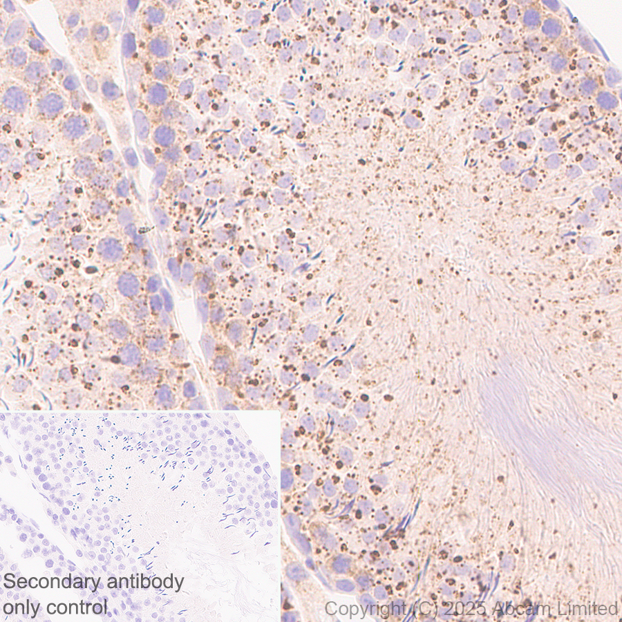 Immunohistochemistry (Formalin/PFA-fixed paraffin-embedded sections) - Anti-TMEM175 antibody [EPR29579-563] (ab323710), expandable thumbnail