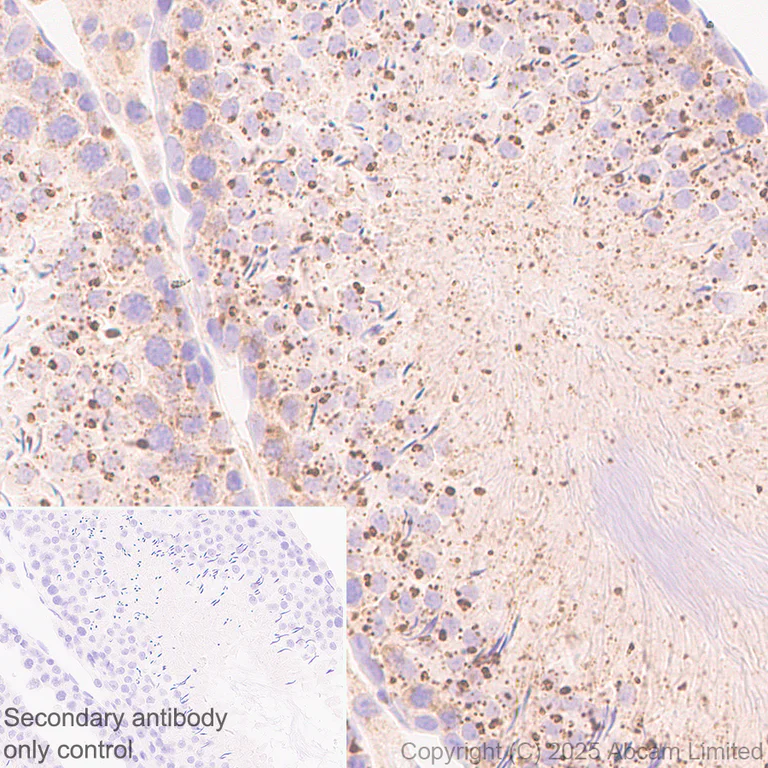 Immunohistochemistry (Formalin/PFA-fixed paraffin-embedded sections) - Anti-TMEM175 antibody [EPR29579-563] (AB323710)