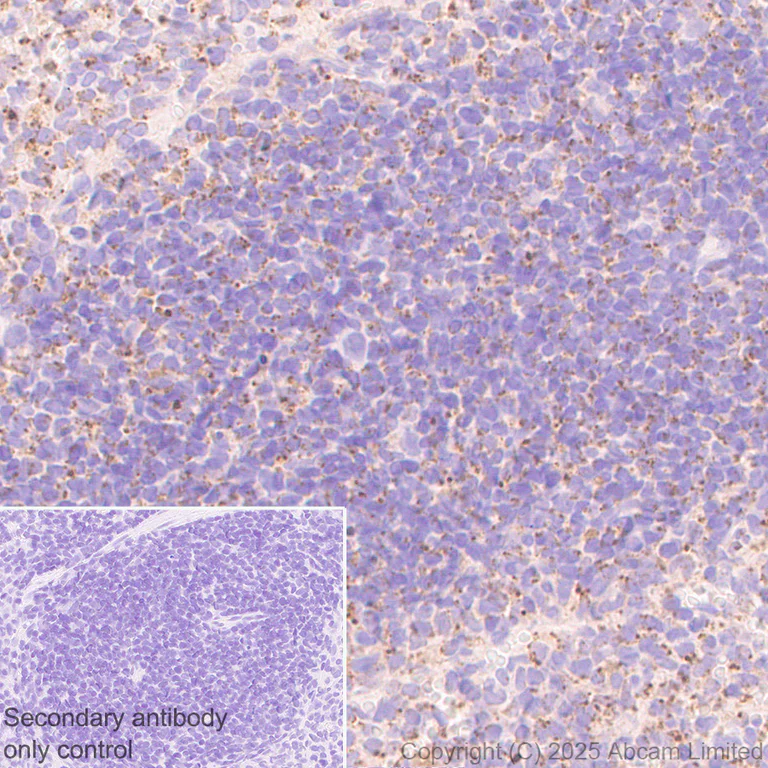 Immunohistochemistry (Formalin/PFA-fixed paraffin-embedded sections) - Anti-TMEM175 antibody [EPR29579-563] (AB323710)