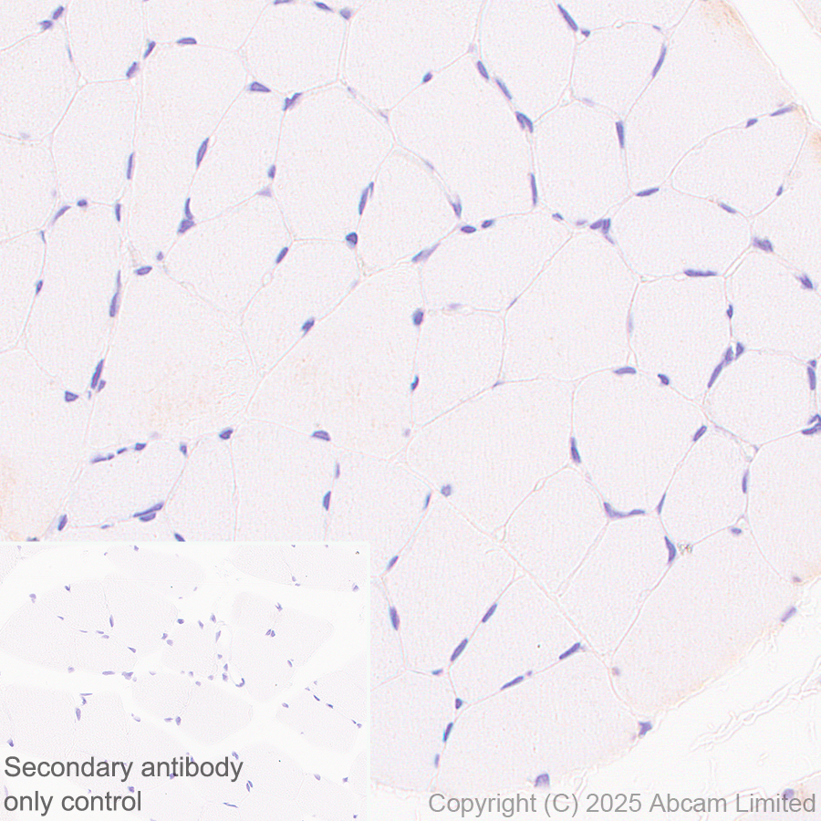 Immunohistochemistry (Formalin/PFA-fixed paraffin-embedded sections) - Anti-TMEM175 antibody [EPR29579-563] (ab323710), expandable thumbnail