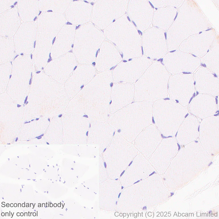 Immunohistochemistry (Formalin/PFA-fixed paraffin-embedded sections) - Anti-TMEM175 antibody [EPR29579-563] (AB323710)