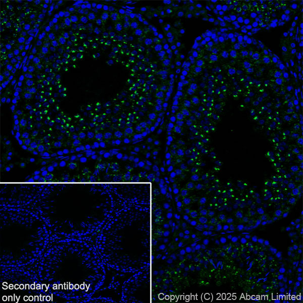 Immunohistochemistry (Frozen sections) - Anti-TMEM175 antibody [EPR29579-563] (ab323710), expandable thumbnail