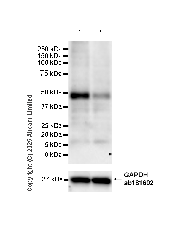 Western blot - Anti-TMEM175 antibody [EPR29579-563] (ab323710), expandable thumbnail