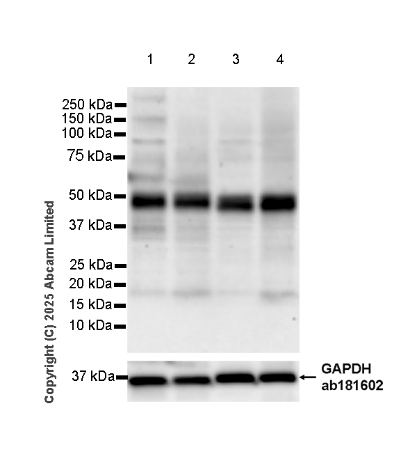 Western blot - Anti-TMEM175 antibody [EPR29579-563] (AB323710), expandable thumbnail