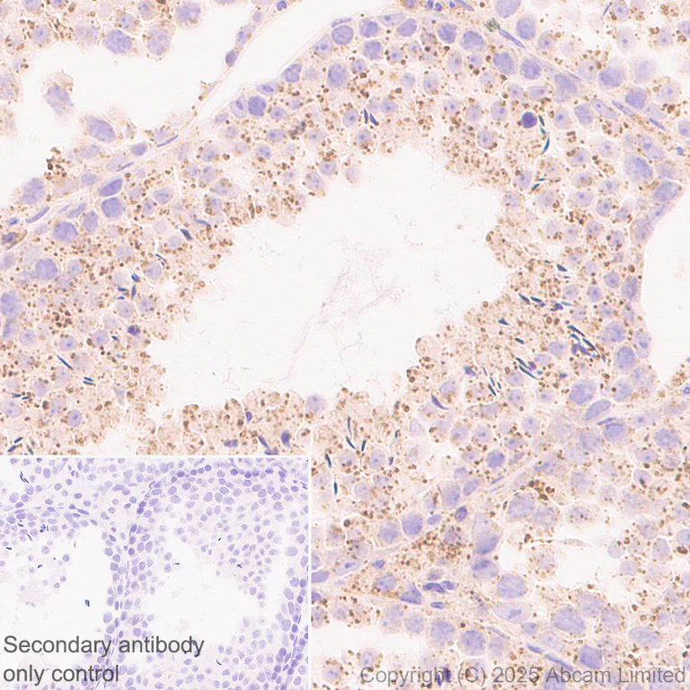 Immunohistochemistry (Formalin/PFA-fixed paraffin-embedded sections) - Anti-TMEM175 antibody [EPR29579-563] - BSA and Azide free (AB325957)