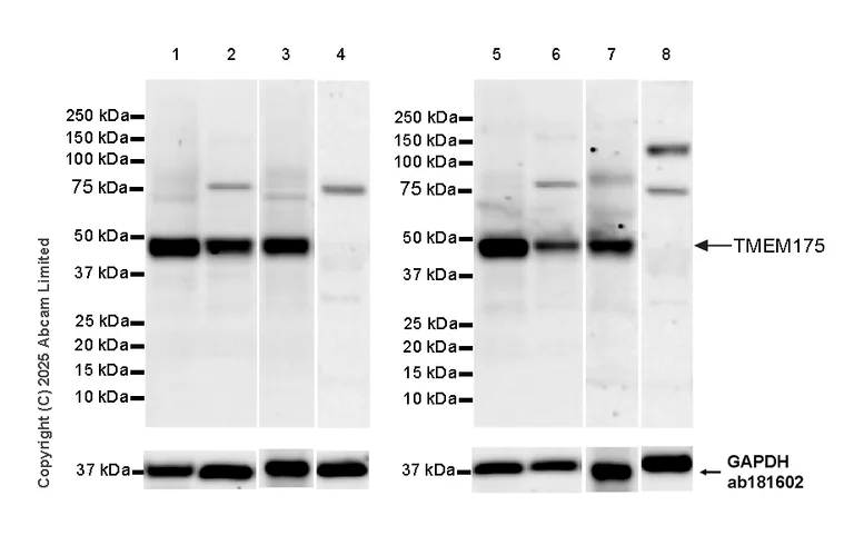 Western blot - Anti-TMEM175 antibody [EPR29579-563] - BSA and Azide free (AB325957)