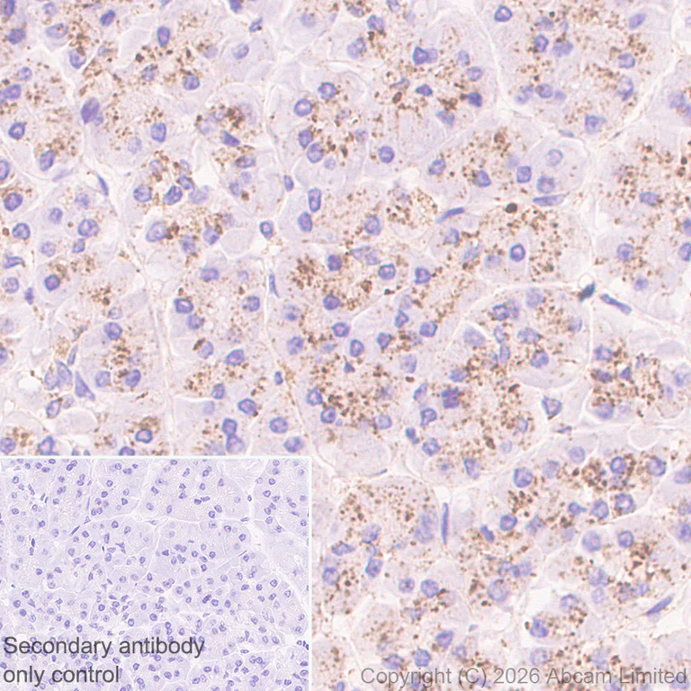 Immunohistochemistry (Formalin/PFA-fixed paraffin-embedded sections) - Anti-TMEM175 antibody [RM1351] (AB325021)