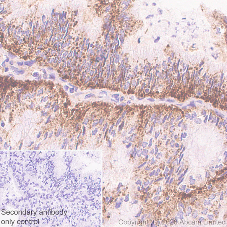 Immunohistochemistry (Formalin/PFA-fixed paraffin-embedded sections) - Anti-TMEM175 antibody [RM1351] (AB325021)
