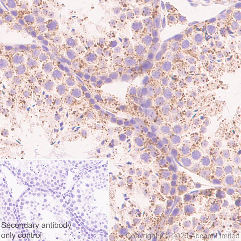 Immunohistochemistry (Formalin/PFA-fixed paraffin-embedded sections) - Anti-TMEM175 antibody [RM1351] (AB325021)