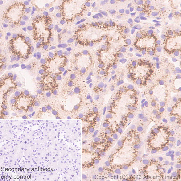 Immunohistochemistry (Formalin/PFA-fixed paraffin-embedded sections) - Anti-TMEM175 antibody [RM1351] (AB325021)