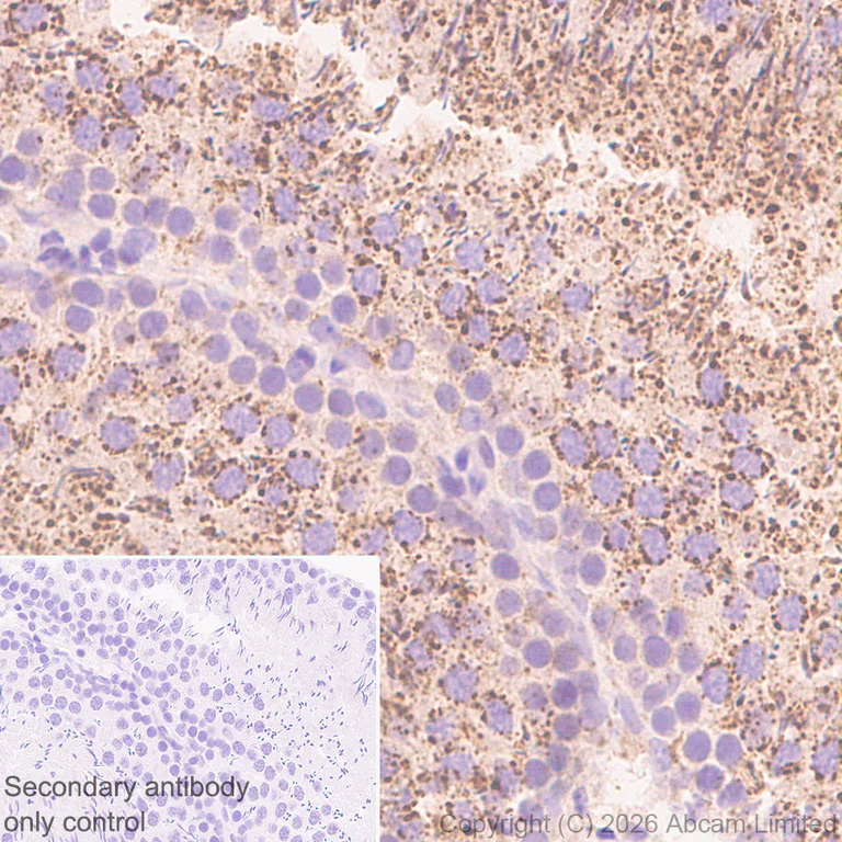 Immunohistochemistry (Formalin/PFA-fixed paraffin-embedded sections) - Anti-TMEM175 antibody [RM1351] (AB325021)