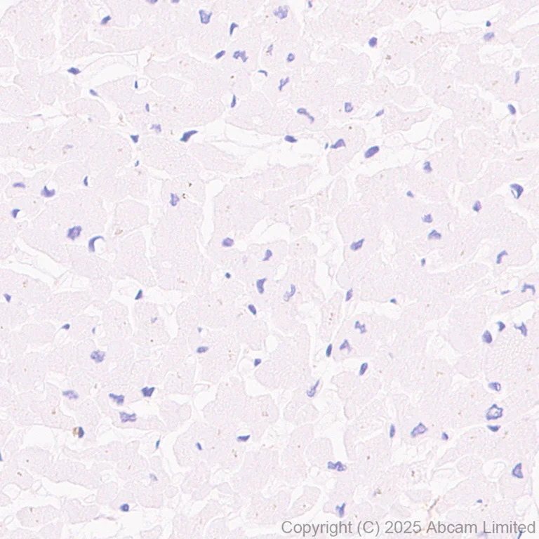 Immunohistochemistry (Formalin/PFA-fixed paraffin-embedded sections) - Anti-TMEM175 antibody [RM1351] (AB325021)
