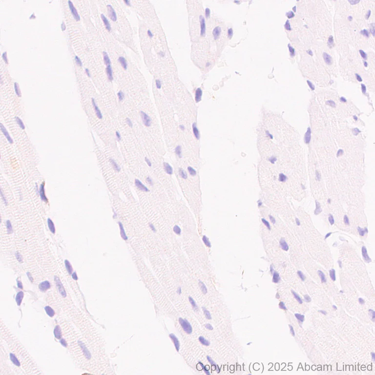 Immunohistochemistry (Formalin/PFA-fixed paraffin-embedded sections) - Anti-TMEM175 antibody [RM1351] (AB325021)