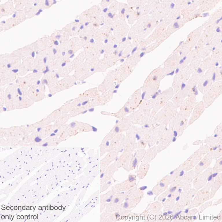Immunohistochemistry (Formalin/PFA-fixed paraffin-embedded sections) - Anti-TMEM175 antibody [RM1351] (AB325021)