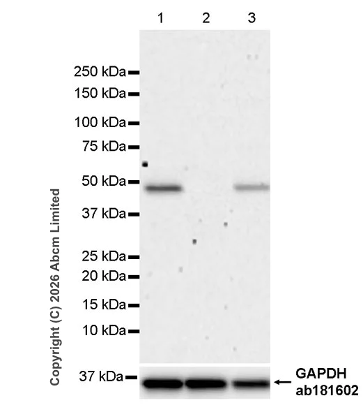 Western blot - Anti-TMEM175 antibody [RM1351] (AB325021)
