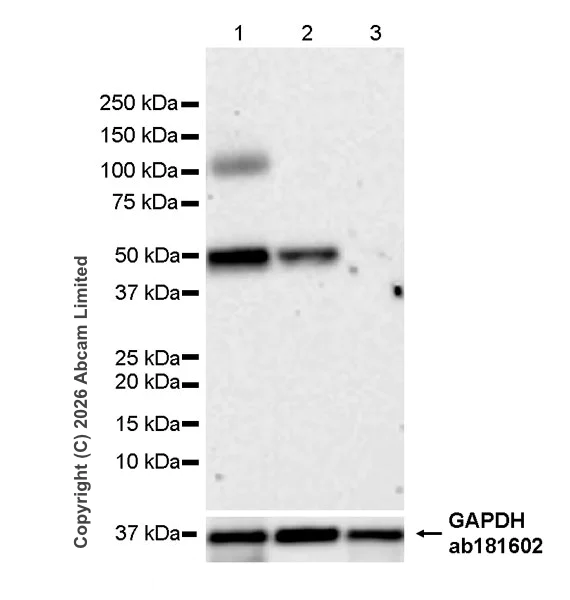 Western blot - Anti-TMEM175 antibody [RM1351] (AB325021)