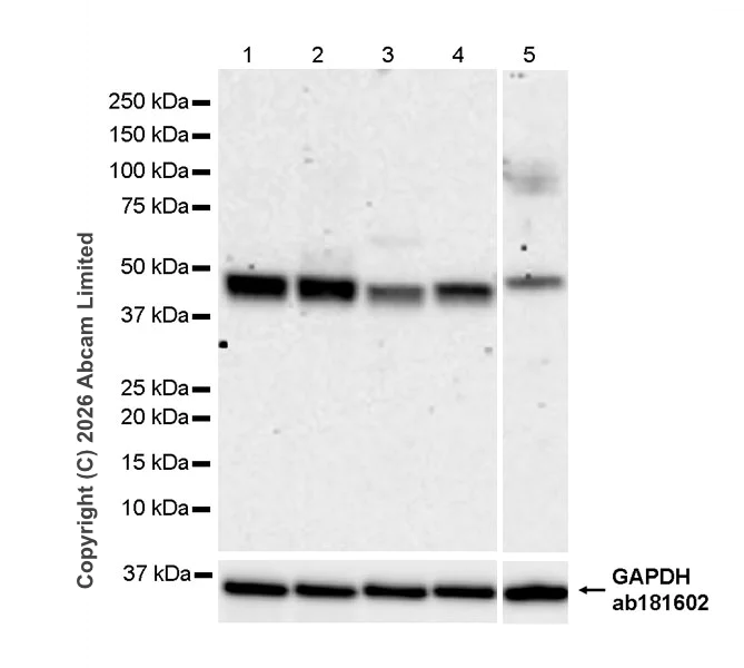 Western blot - Anti-TMEM175 antibody [RM1351] (AB325021)